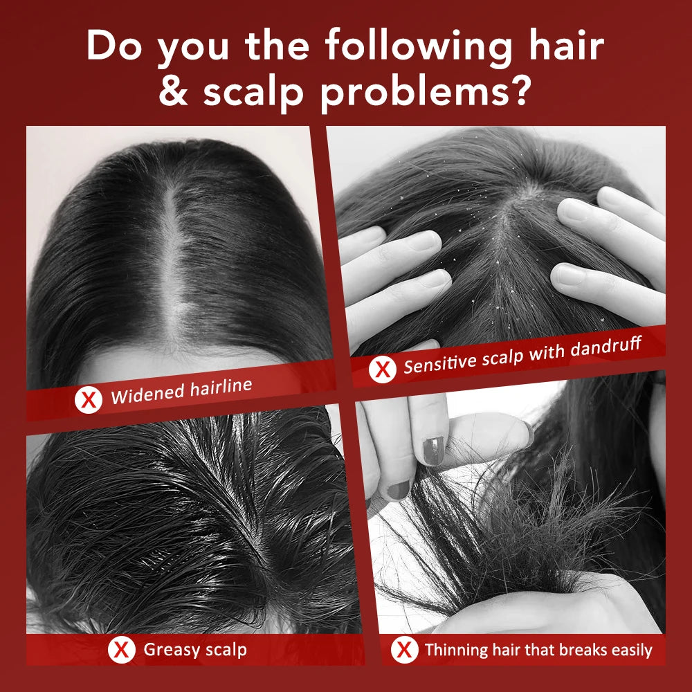 Electric Hair Regrowth Brush – Infrared Light Scalp Massager for Anti-Hair Loss & Hair Growth