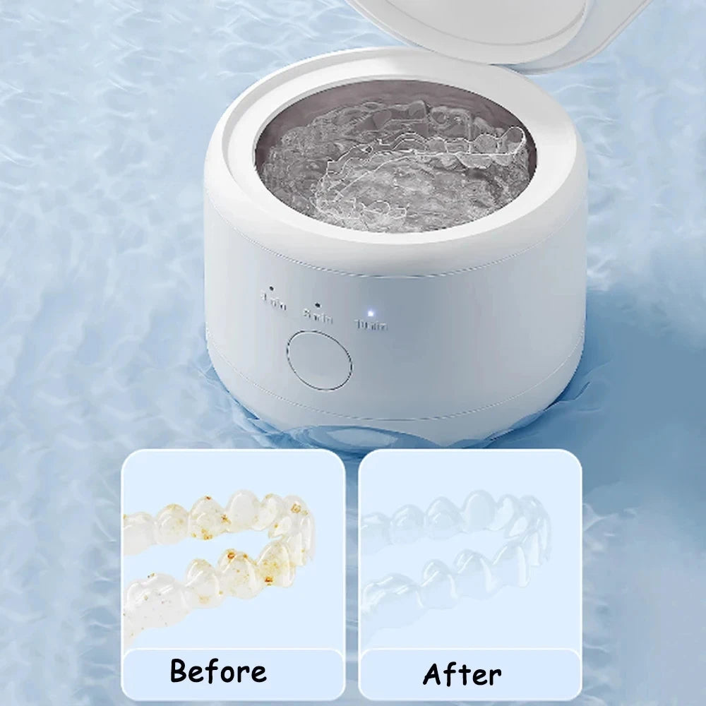 Ultrasonic Cleaner 50kHz – High-Frequency Cleaning Machine for Jewelry & Teeth Braces
