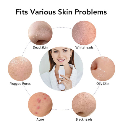 Ultrasonic Skin Scrubber Skin Spatula Ion Deep Face Cleaning 4 Modes Facial Lifting Ultrasonic Cleaner Peeling Skin Care Device