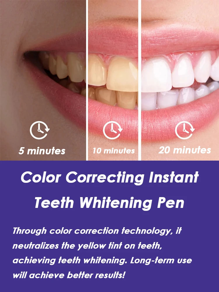 Instant Teeth Whitening Pen – Purple Formula for Tooth Stain Removal, No Sensitivity