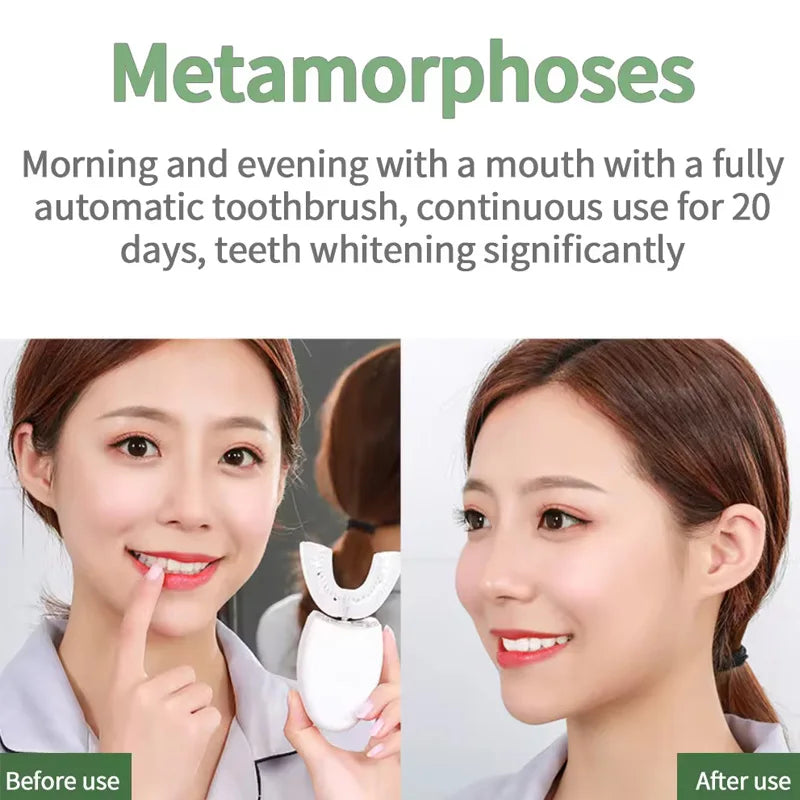 Home Use Teeth Whitening Kit with 5 LED Blue Lights 30 Mins Battery Version Powder Version