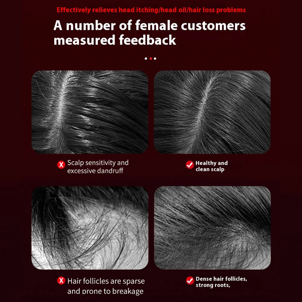 Electric Hair Regrowth Brush – Infrared Light Scalp Massager for Anti-Hair Loss & Hair Growth