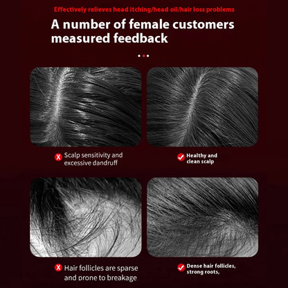 Electric Hair Regrowth Brush – Infrared Light Scalp Massager for Anti-Hair Loss & Hair Growth